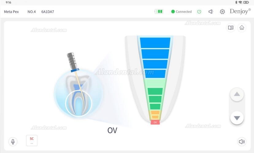 Denjoy MeteEndo Dental Endo Integrated System (with Meta Fill/Meta Pex/Meta Motor/Meta Pulp/Meta Pack)